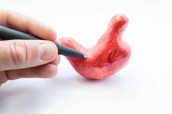 胃癌可以吃腐乳吗