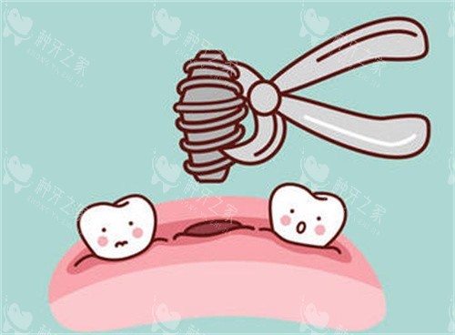 牙齿种植卡通图