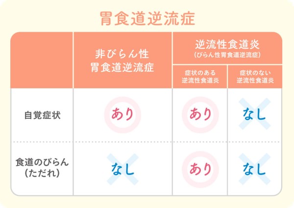 近年増加中！咳の原因にもなる「逆流性食道炎」
