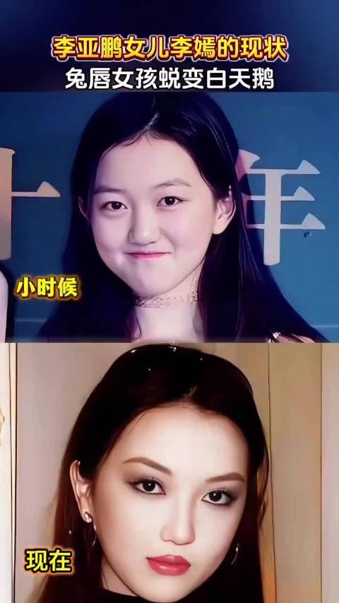 李亚鹏干的是功德无量的事，值得尊重