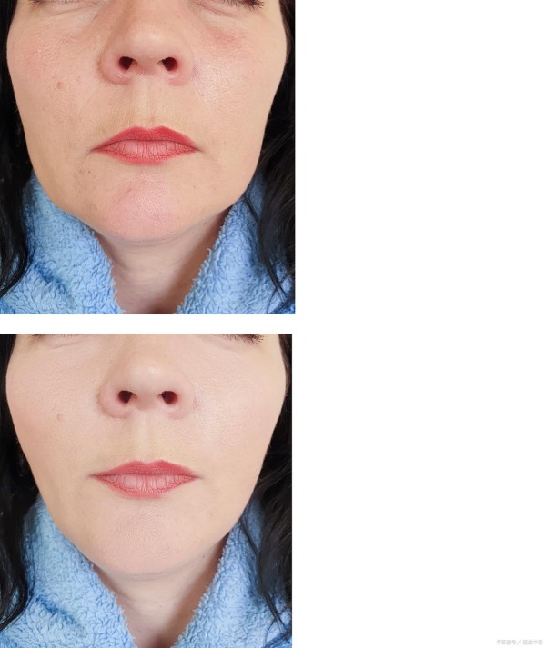 逆龄秘籍：6个低成本妙招让皮肤紧致回弹