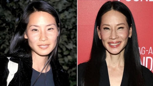 57岁刘玉玲自曝医疗事故：仅凭手感被误诊癌症，切除后竟是良性！