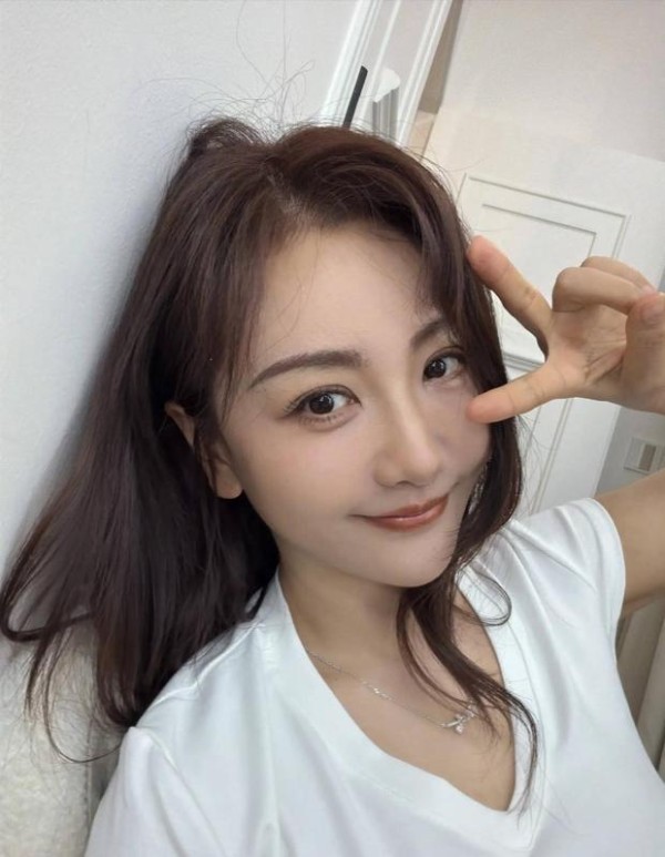 杨蓉晒出面部恢复近照 皮肤白皙无暇气色极佳