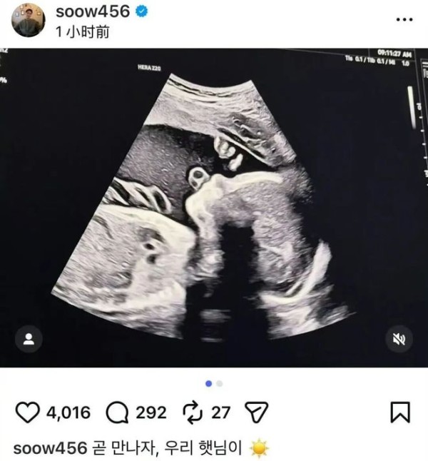 宋承炫官宣当爸！这速度是“奉子成婚”还是早有规划