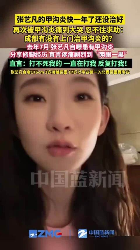 张艺凡的甲沟炎快一年了还没治好