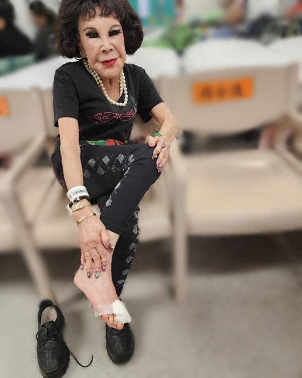 95岁香港女星紧急入院！右脚发炎急症求诊，医院苦等12小时太心酸