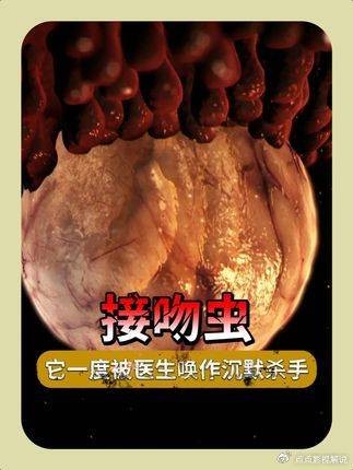 豪斯医生：脸上被“亲”后心脏停跳，这竟不是恐怖片！