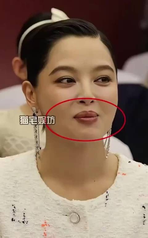 辛芷蕾嘴唇变化真相曝光