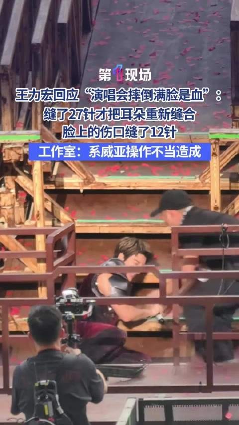 王力宏缝了39针