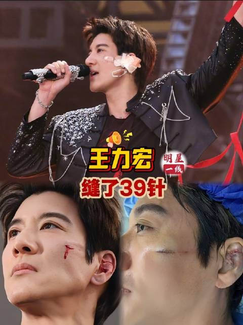 王力宏演唱会跌倒受伤缝39针，凌晨声明报平安