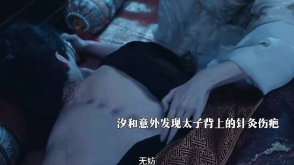 汐和意外发现萧华雍后背密密麻麻针灸伤疤,满眼心疼