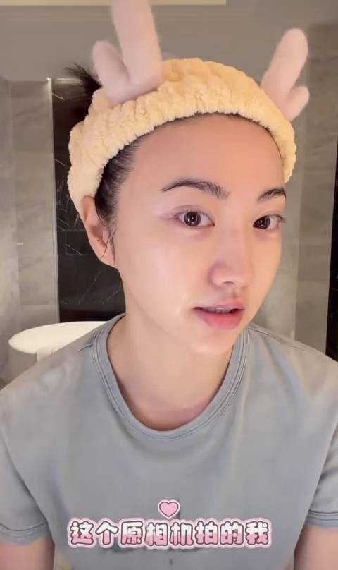 这次自己亲自解释鼻梁上的疤咋来的,暴力甜妈 不能模仿啊