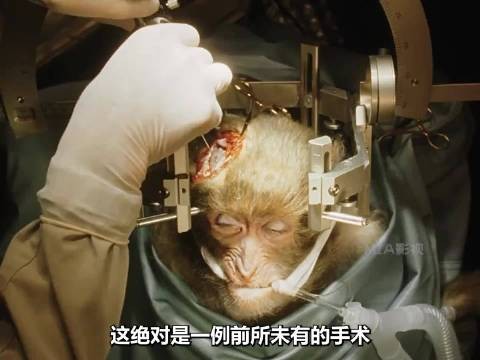 这是一场史无前例的手术! 惊悚 高分电影 科幻