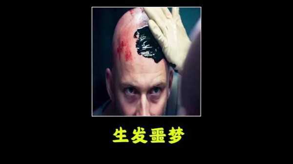 为长出头发猛涂生发液,三小时后头皮长出脓包