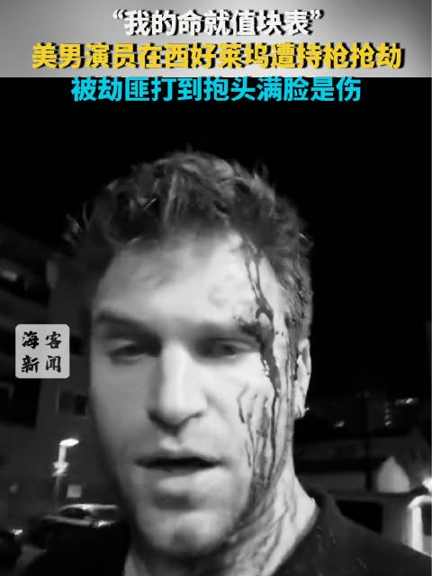 “我的命就值块表”美国男演员在西好莱坞遭持枪抢劫 被劫匪打到抱头满脸是伤